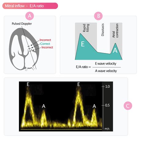 diastolic function assessment by echo.